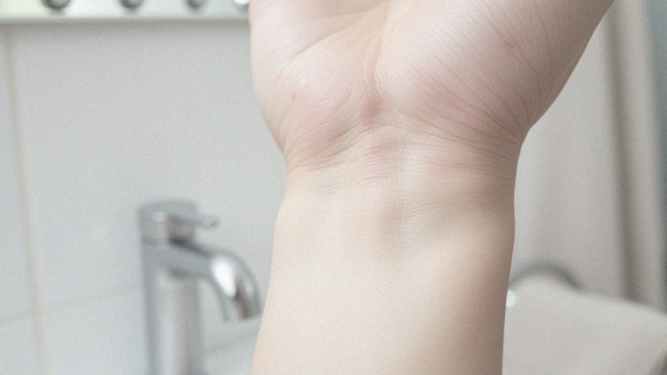 Jakie są podobieństwa między świerzbem a łojotokowym zapaleniem skóry?